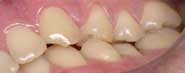 teeth