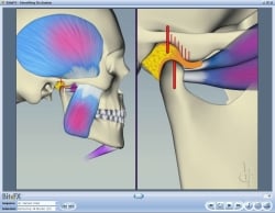 Fig10 Animation Showing Warring Muscles