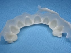Fig16 Provisionals Removed