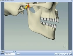 Fig9 Animation Showing Stable No Muscles Opening