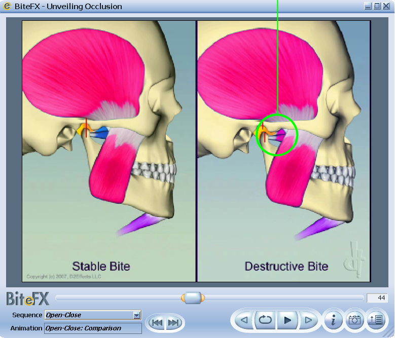 Pre Clinical Interview Open Closed Comparison