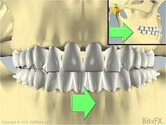 Slide with lateral component