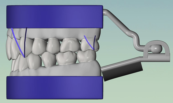 Hinge-Articulator-With-Traces