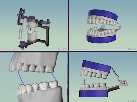 ArticulatorComp