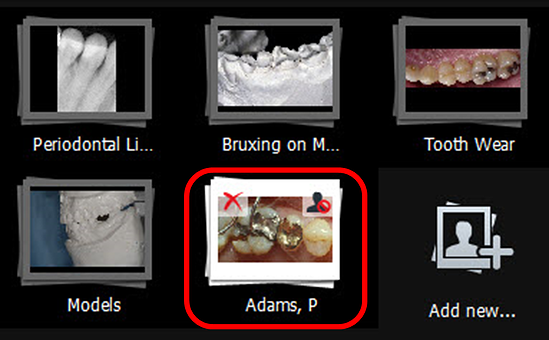 Imported Album with Border