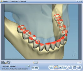 Broken Molar Surrounded by Others