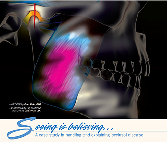 Explaining and Handling Occlusal Disease