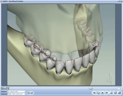 Fig11 Animation Showing All Tooth Contacts