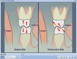 Fig4 Animation Comparing Molar Contacts