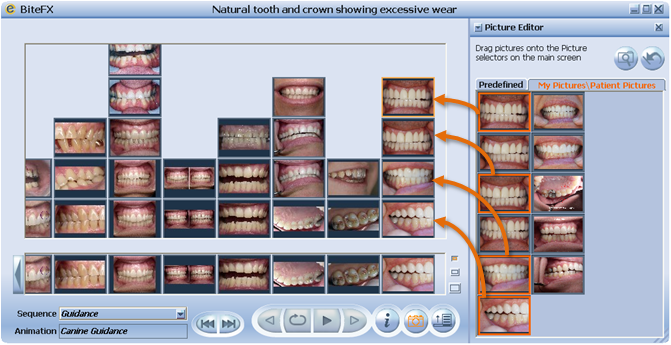 Can You Say This About Your Dental Patient Education: “If a Picture is ...