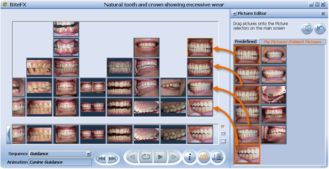 Placing Dental Clinical Pictures