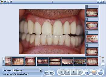 Selecting Dental Clinical Pictures