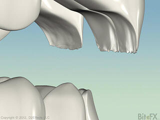 envelope-of-function-knife-edge-wear.jpg