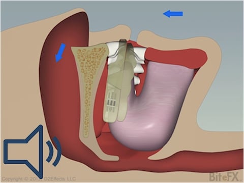 best way to sleep with compression fracture