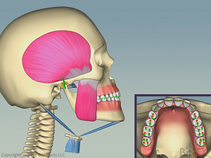 AOJ-Head-Tilted-Back-300x225