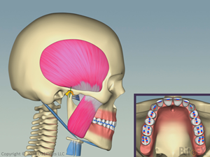 AOJ-Head-Tilted-Forward-300x225