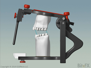 Articulator-Comparison-Denar-300-x-224