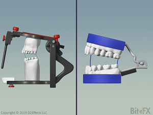 Articulator-Comparison-Issues-Denar-300-x-225