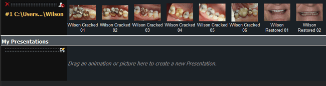 Wilson Import with V4