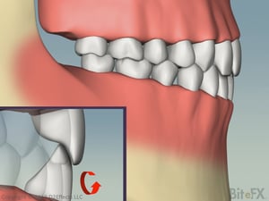 ChewingAndEnvelopeOfFunction-Horizontal-Profile-1