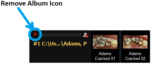 Remove Album Icon V4
