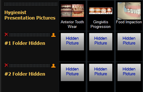 Albums with All Hidden Folders V4