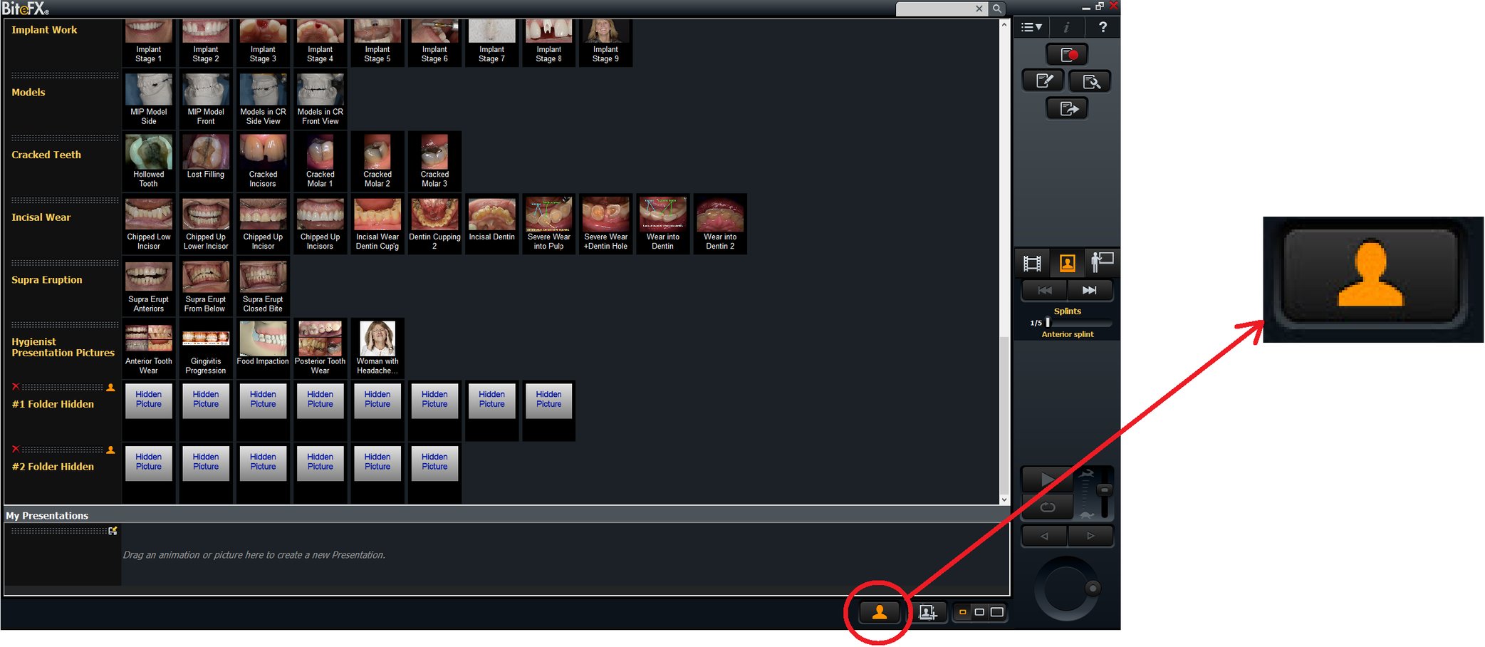 How to Use the Hide/Unhide Image Controls in BiteFX for Windows