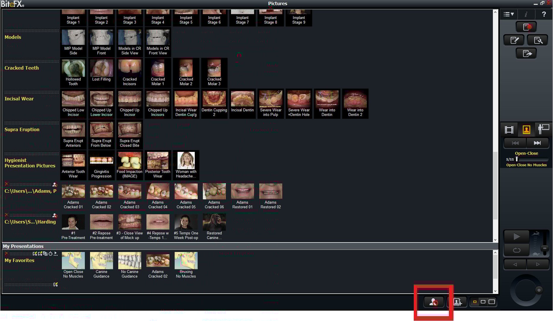 How to Use the Hide/Unhide Image Controls in BiteFX for Windows