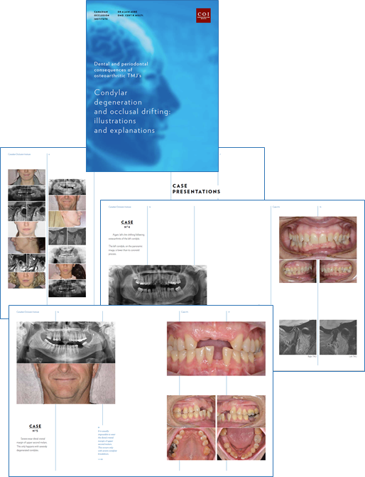 Condylar Degeneration Sample Pages.png