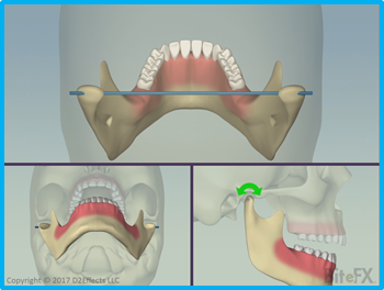 Mandibular-Motions-Three-Views-Rotation.png