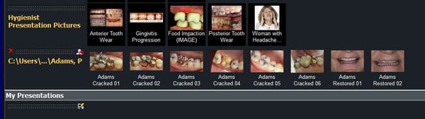 V3 Imported Picture Row