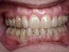 teeth