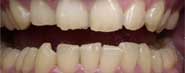 teeth